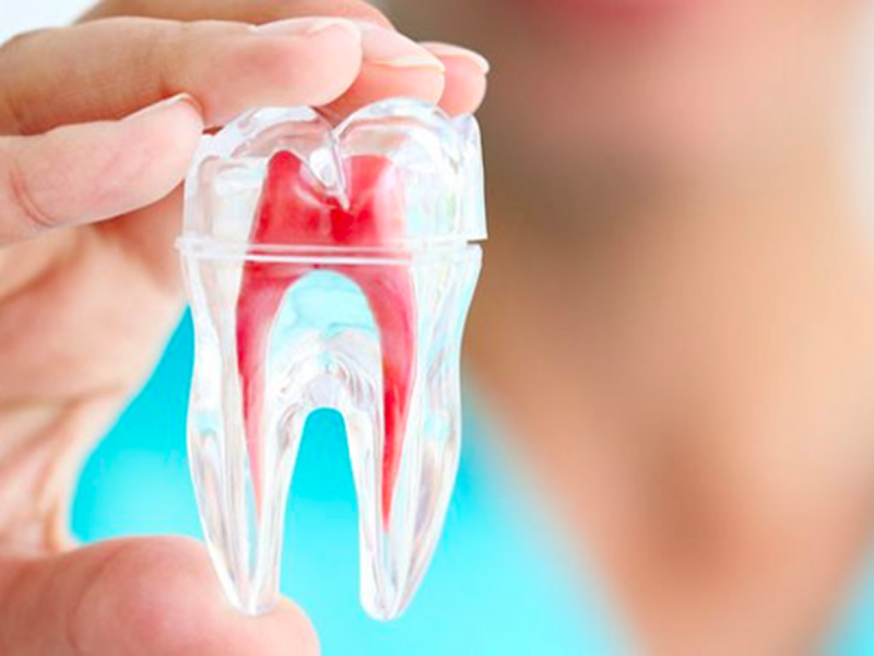 Kanal Tedavisi - Endodonti - Set Dent Ağız ve Diş Sağlığı Polikliniği - SET Dent Clinic